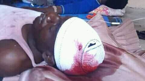  Police shot him during peaceufl free zakzaky protest abuja on 16th April 2018 